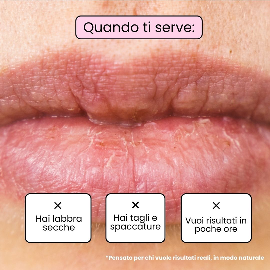 Balsamo Labbra BERRY - Mora e Mirtillo