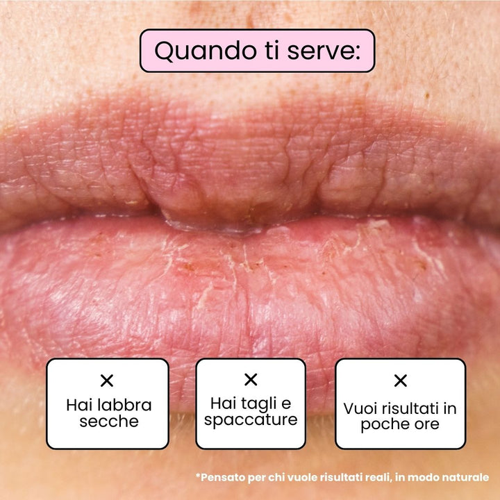 Balsamo Labbra BERRY - Mora e Mirtillo
