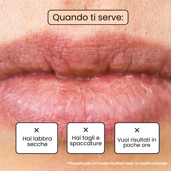 Balsamo Labbra JUICY - Mango